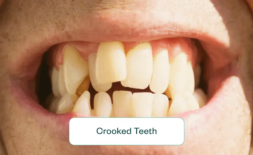 Crooked
