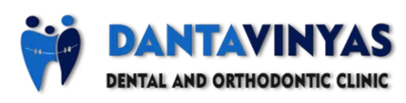 Invisalign treatment in Bangalore